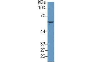 Western Blotting (WB) image for Heat Shock 60kDa Protein 1 (Chaperonin) (HSPD1) ELISA Kit (ABIN6574222)