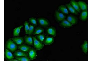 Immunofluorescent analysis of A549 cells using ABIN7175353 at dilution of 1:100 and Alexa Fluor 488-congugated AffiniPure Goat Anti-Rabbit IgG(H+L) (VPS39 antibody  (AA 263-490))