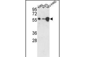 Western blot analysis of hUSP3- (ABIN388881 and ABIN2839174) in K562, , NCI- cell line lysates (35 μg/lane).