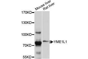 Western blot analysis of extracts of various cell lines, using YME1L1 antibody (ABIN4905647) at 1:1000 dilution. (YME1L1 antibody)