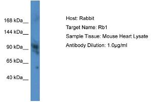 Host: Rabbit Target Name: Rb1 Sample Type: Mouse Heart lysates Antibody Dilution: 1. (Retinoblastoma 1 antibody  (Middle Region))