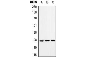 Western blot analysis of RAB33A expression in HEK293T (A), Raw264. (RAB33A antibody  (Center))