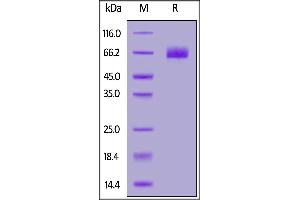 Fed Human B7-H3 (4Ig), His Tag on  under reducing (R) condition. (B7-H3 (4Ig) (AA 27-461) (Active) protein (His tag,FITC))
