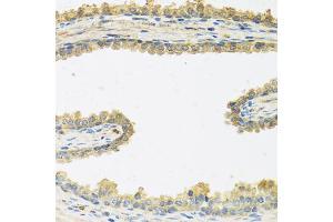 Immunohistochemistry of paraffin-embedded human prostate using CRHBP antibody (ABIN5973945) at dilution of 1/100 (40x lens).
