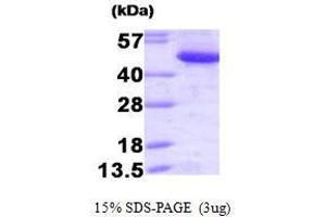 Figure annotation denotes ug of protein loaded and % gel used. (CTBP1 Protein (AA 1-440))