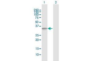 Western Blot analysis of ANKRA2 expression in transfected 293T cell line by ANKRA2 MaxPab polyclonal antibody.