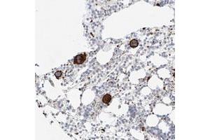 Immunohistochemical staining of human bone marrow with LOC389813 polyclonal antibody  shows strong cytoplasmic and membrane positivity in bone marrow poietic cells at 1:50-1:200 dilution. (AJM1/C9ORF172 antibody)