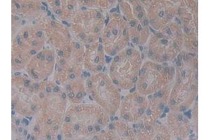 Detection of GHR in Rat Kidney Tissue using Polyclonal Antibody to Growth Hormone Receptor (GHR) (Growth Hormone Receptor antibody  (AA 353-588))