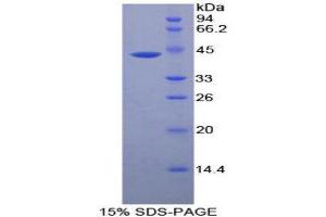 SDS-PAGE (SDS) image for Creatine Kinase, Muscle (CKM) (AA 11-367) protein (His tag) (ABIN1099000) (CKM Protein (AA 11-367) (His tag))