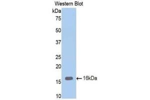 Detection of Recombinant ENG, Mouse using Polyclonal Antibody to Endoglin (ENG) (Endoglin antibody  (AA 336-450))
