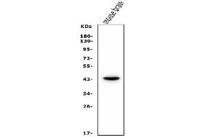 Western blot analysis of LHX1 using anti-LHX1 antibody (ABIN7599263).