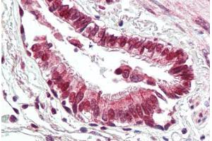 Human Lung, Respiratory Epithelium (formalin-fixed, paraffin-embedded) stained with BECN1 antibody ABIN461894 at 2. (Beclin 1 antibody  (C-Term))