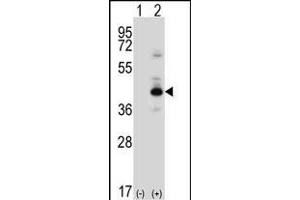 Western blot analysis of PRKACB (arrow) using rabbit polyclonal PRKACB Antibody (K29) (ABIN6243845 and ABIN6578978). (PRKACB antibody  (N-Term))