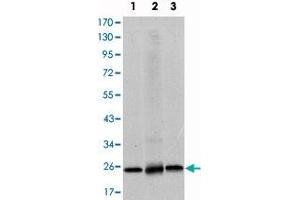 Western blot analysis using EIF4E monoclonal antibody, clone 5D11  against HeLa (1) , HEK293 (2) and K-562 (3) cell lysate.