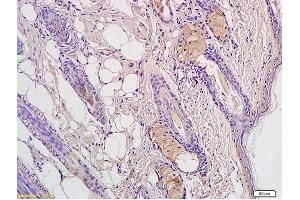 Immunohistochemistry (IHC) image for anti-CD4 (CD4) (AA 231-330) antibody (ABIN672936)