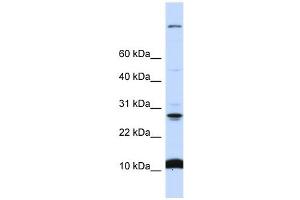 C19ORF56 antibody used at 1 ug/ml to detect target protein. (C19orf56 antibody  (N-Term))