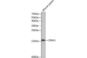 Western blot analysis of extracts of mouse spleen, using SSN antibody (3377) at 1:1000 dilution.