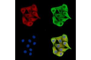 ABIN7096450 and ABIN7100514 staining Hela cells by IF/ICC.