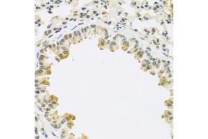 Immunohistochemistry of paraffin-embedded mouse lung using TGFB3 antibody (ABIN5974864) at dilution of 1/100 (40x lens). (TGFB3 antibody)