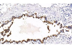 Immunohistochemistry (IHC) image for anti-Keratin 18 (KRT18) (AA 72-380) antibody (ABIN7433291)