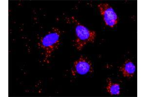 Proximity Ligation Assay (PLA) image for anti-DNA Fragmentation Factor, 45kDa, alpha Polypeptide (DFFA) (AA 231-331) antibody (ABIN514956)