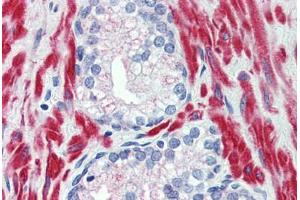 Anti-TRPM8 antibody  ABIN960829 IHC staining of human prostate. (TRPM8 antibody  (N-Term))