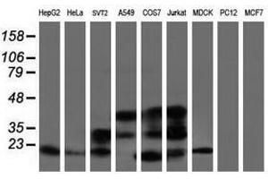 ARL2BP antibody