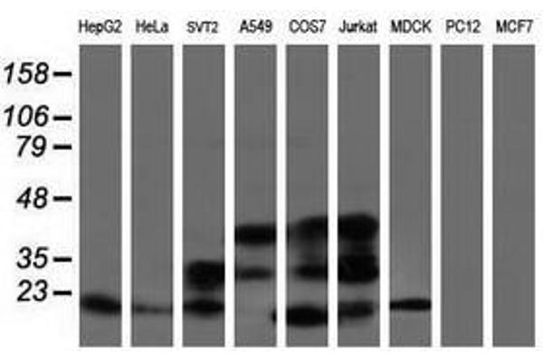 ARL2BP antibody