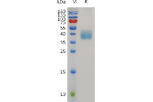 SDS-PAGE (SDS) image for Mesothelin (MSLN) (AA 298-600) protein (His tag) (ABIN7491033)