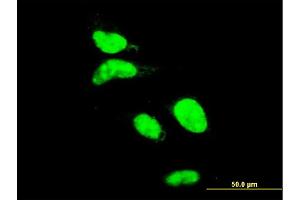 Immunofluorescence of monoclonal antibody to AATF on HeLa cell. (AATF antibody  (AA 151-250))