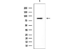 Western blot analysis of lysates from EC304 cells, using CTNNAL1 Mouse Monoclonal Antibody at 1/1000 dilution.