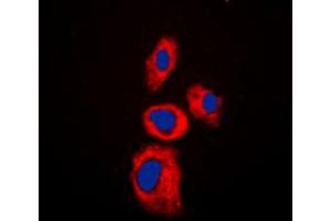 Immunofluorescent analysis of AIM2 staining in Jurkat cells. (AIM2 antibody  (Center))