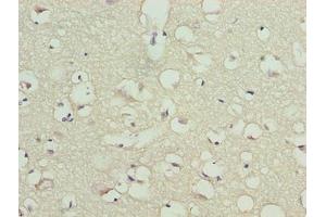 Immunohistochemistry of paraffin-embedded human brain tissue using ABIN7172953 at dilution of 1:100 (TMCC1 antibody  (AA 51-300))