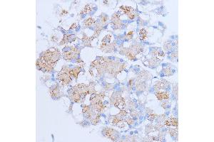 Immunohistochemistry of paraffin-embedded rat pancreas using NME6 antibody (ABIN7268942) at dilution of 1:100 (40x lens). (NME6 antibody  (AA 9-194))