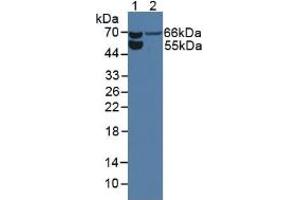 Western blot analysis of (1) Rat Serum and (2) Rat Kidney Tissue. (Endoglin antibody  (AA 26-136))