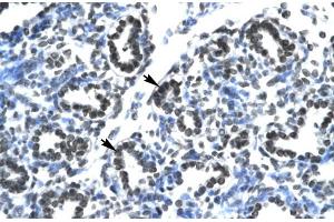 Human Lung; CLDN17 antibody - middle region in Human Lung cells using Immunohistochemistry (Claudin 17 antibody  (Middle Region))