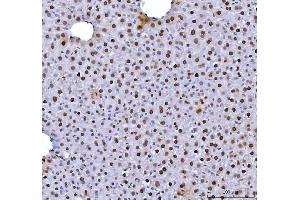IHC analysis of HNRNPL using anti-HNRNPL antibody (ABIN4886624). (HNRNPL antibody  (C-Term))