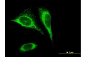 Immunofluorescence of purified MaxPab antibody to SLC25A24 on HeLa cell.