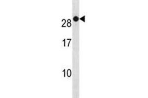 RAB7B antibody western blot analysis in A2058 lysate. (RAB7B antibody  (AA 168-197))