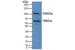 Western blot analysis of Human Liver Tissue. (PKN1 antibody  (AA 615-874))