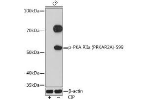 Western blot analysis of extracts of C6 cells, using Phospho-PKA RIIα (PRKA)-S99 Rabbit mAb (ABIN7269661) at 1:1000 dilution. (PRKAR2A antibody  (pSer99))