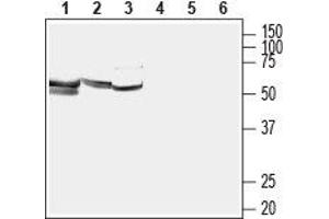 Western blot analysis of rat placenta lysate (lanes 1 and 4), mouse testes lysate (lanes 2 and 5) and rat skeletal muscle membrane (lanes 3 and 6): - 1-3. (SLC7A5 antibody  (AA 222-235))