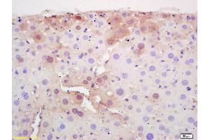 Formalin-fixed and paraffin embedded mouse liver labeled with Rabbit Anti CPT2 Polyclonal Antibody, Unconjugated (ABIN708881) at 1:200 followed by conjugation to the secondary antibody and DAB staining (CPT2 antibody  (AA 401-500))