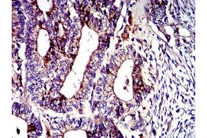 Immunohistochemistry (IHC) image for anti-Lysosomal-Associated Membrane Protein 2 (LAMP2) (AA 29-168) antibody (ABIN5611242)