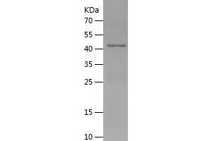 Western Blotting (WB) image for Perilipin 2 (PLIN2) (AA 82-311) protein (His-IF2DI Tag) (ABIN7124355) (ADRP Protein (AA 82-311) (His-IF2DI Tag))