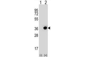Western Blotting (WB) image for anti-Dehydrogenase/reductase (SDR Family) Member 3 (DHRS3) (AA 92-121), (Middle Region) antibody (ABIN951904)