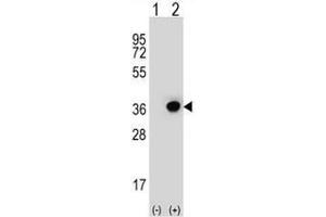 Western blot analysis of DHRS3 (arrow) using rabbit polyclonal DHRS3 Antibody (Center) .
