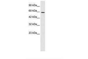 Image no. 1 for anti-T-Box 4 (TBX4) (AA 257-306) antibody (ABIN6735932) (TBX4 antibody  (AA 257-306))