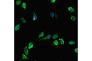 Immunofluorescent analysis of Hela cells using ABIN7155419 at dilution of 1:100 and Alexa Fluor 488-congugated AffiniPure Goat Anti-Rabbit IgG(H+L) (CENPA antibody  (AA 1-50))