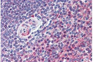 Human Spleen (formalin-fixed, paraffin-embedded) stained with CD97 antibody ABIN292888 at 10 ug/ml followed by biotinylated goat anti-rabbit IgG secondary antibody ABIN481713, alkaline phosphatase-streptavidin and chromogen. (CD97 antibody  (AA 220-270))